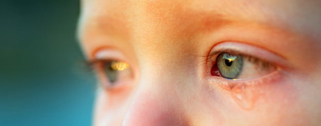 Problemas oculares: como prevenir em crianças?